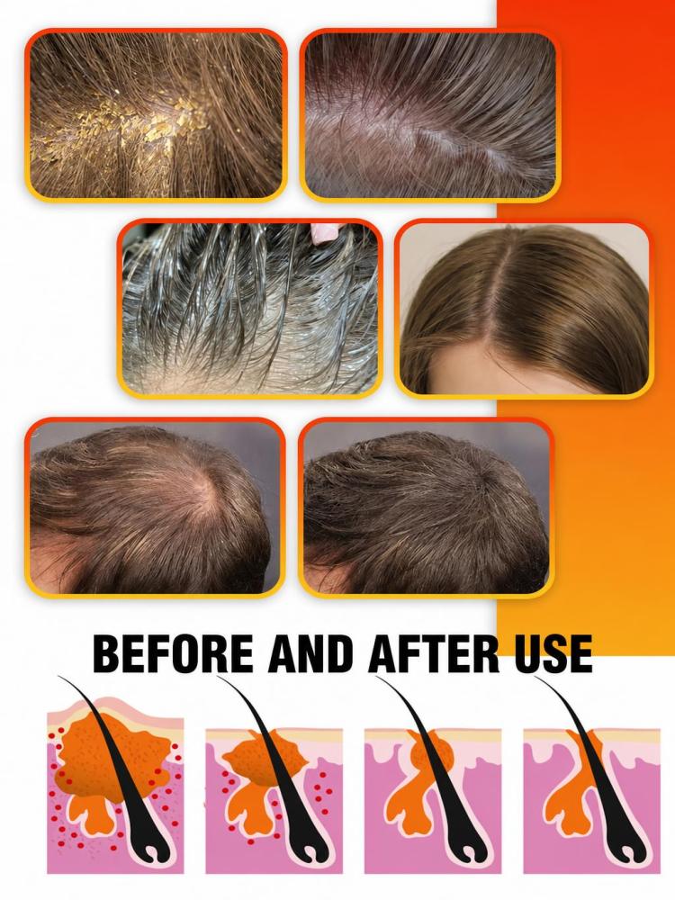 Schwefel-Haarreinigungsshampoo – Hair Care Daily Routine Bewertung und Preis