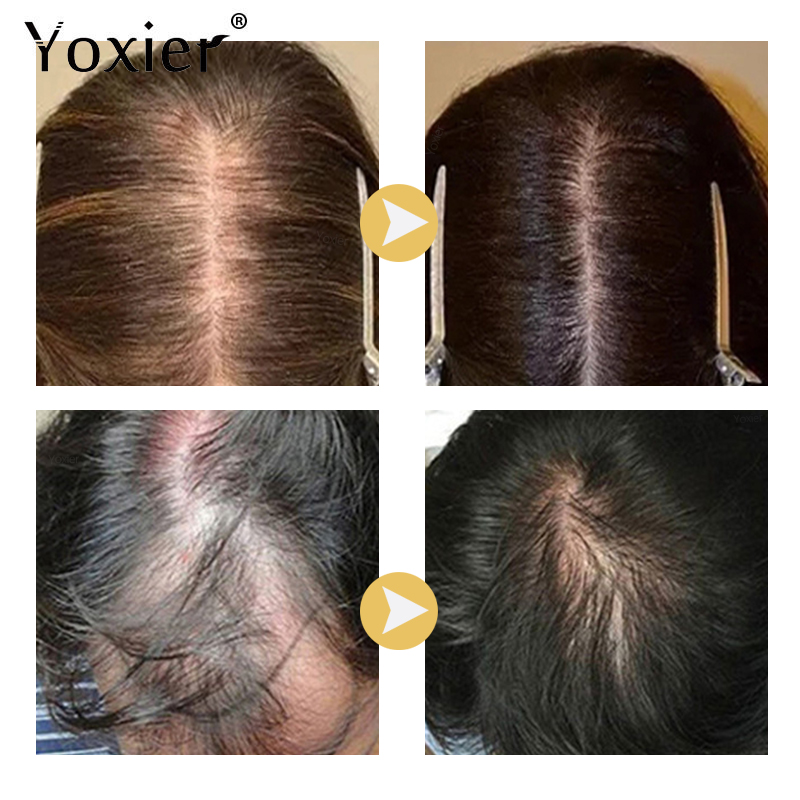 Intensive Wachstum Serum Verhi – Hair Care For Hair Growth Bewertung und Preis
