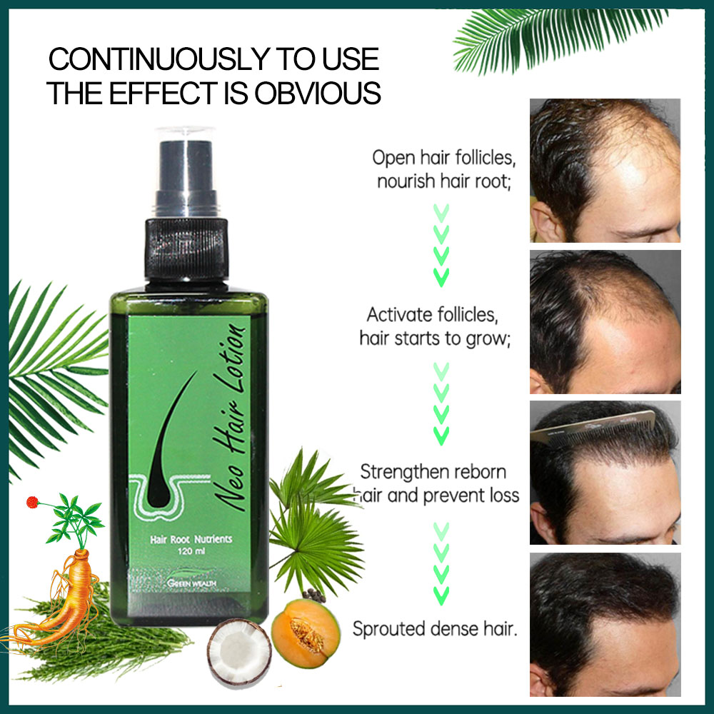 Original Neo Haarlotion 120 ml – Hair Care Thailand Bewertung und Preis
