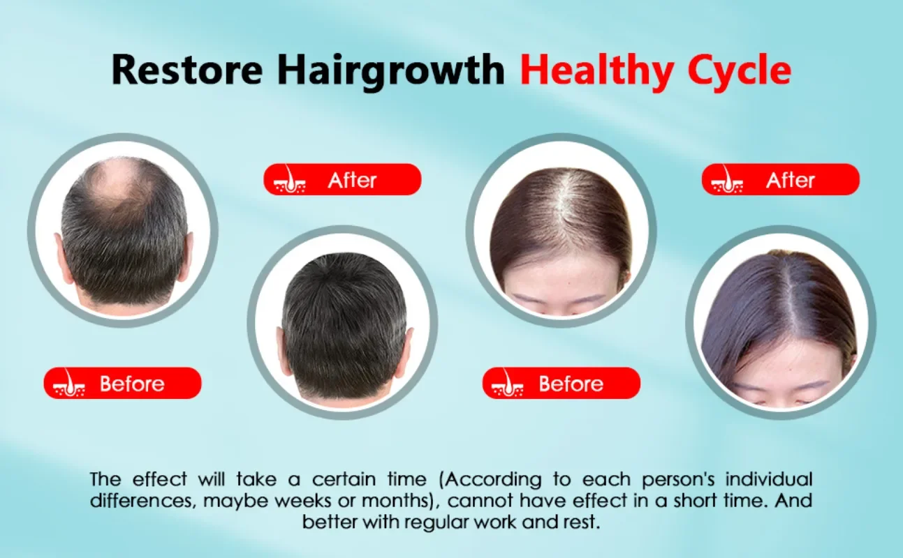 Haarwachstumskappe, wiederaufl – Hair Care Nutrition Bewertung und Preis