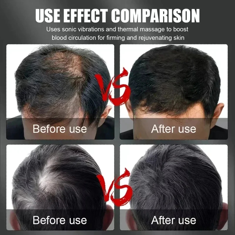 660nm 850nm Rotlicht-Infrarot- – Hair Care For Hair Growth Bewertung und Preis